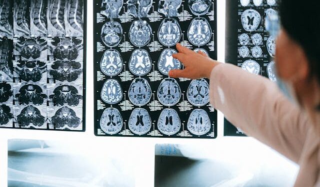 Brain scans being pointed to by a radiologist, suggesting uncovering hidden things.